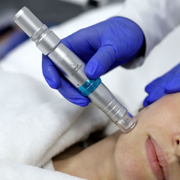 Smart Infusion Pen - Caneta de Microagulhamento de Infus�o El�trica