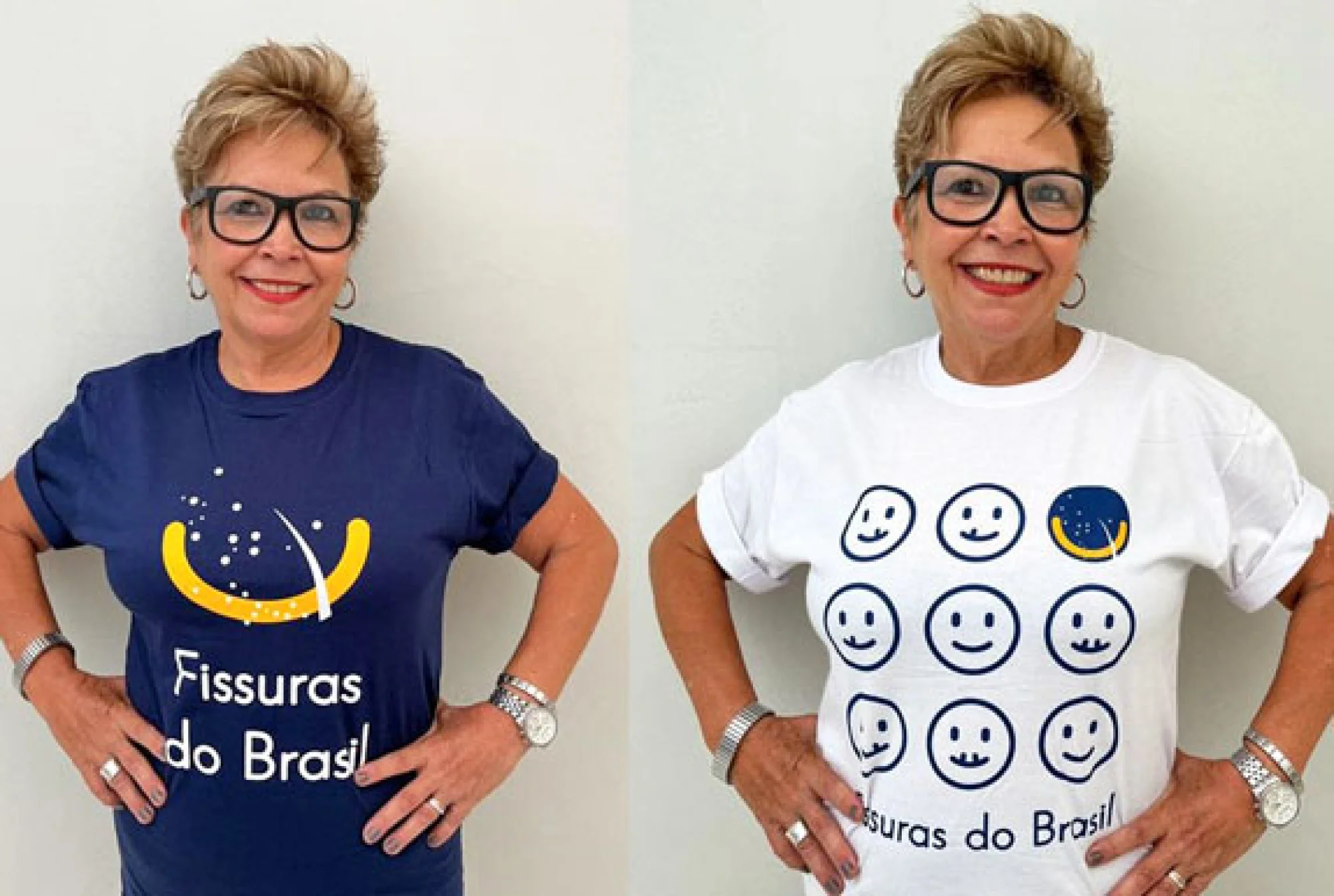 Solidariedade: Vista a camisa Fissuras do Brasil e ajude a Rede Profis