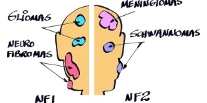 NEUROFIBROMATOSE