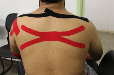 Saiba mais sobre A utiliza��o da bandagem el�stica na SORRI-BAURU.