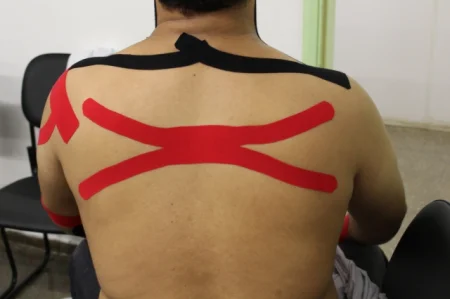 Continue lendo A utiliza��o da bandagem el�stica na SORRI-BAURU.