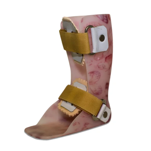 �rteses de mmii confeccionadas sob medida em termomold�vel