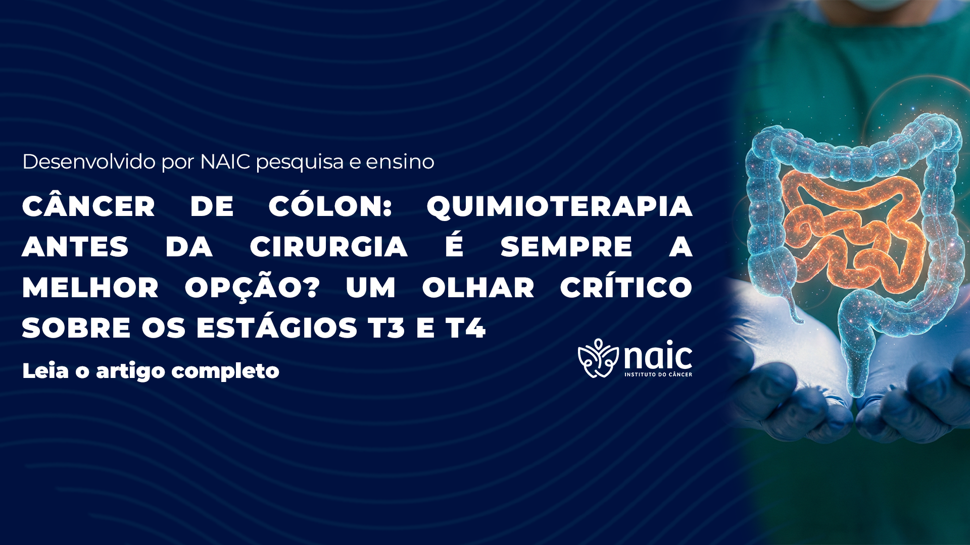 C�ncer de C�lon: Quimioterapia Antes da Cirurgia � Sempre a Melhor Op��o? Um Olhar Cr�tico Sobre os Est�gios T3 e T4