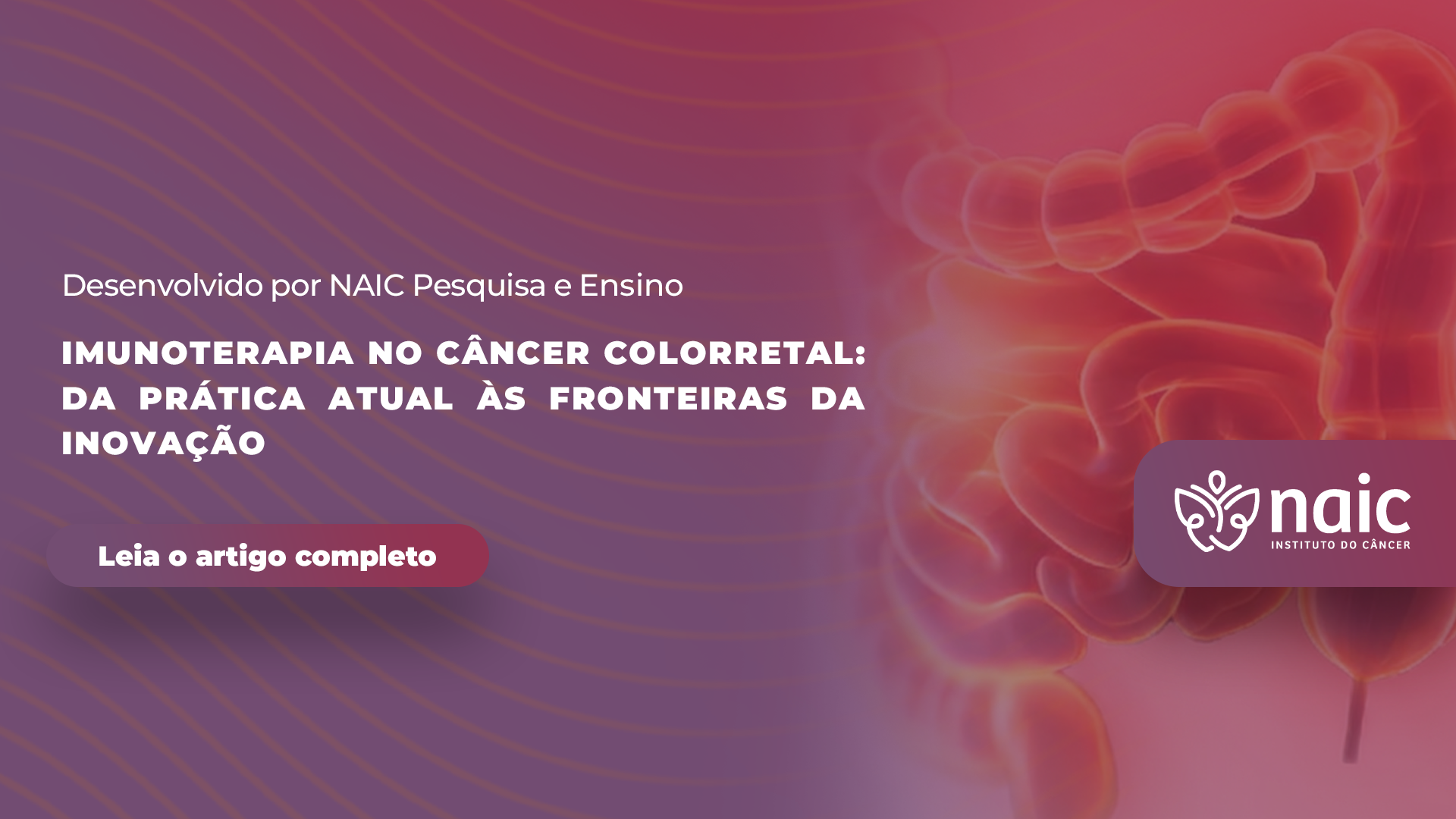 Imunoterapia no C�ncer Colorretal: Da Pr�tica Atual �s Fronteiras da Inova��o