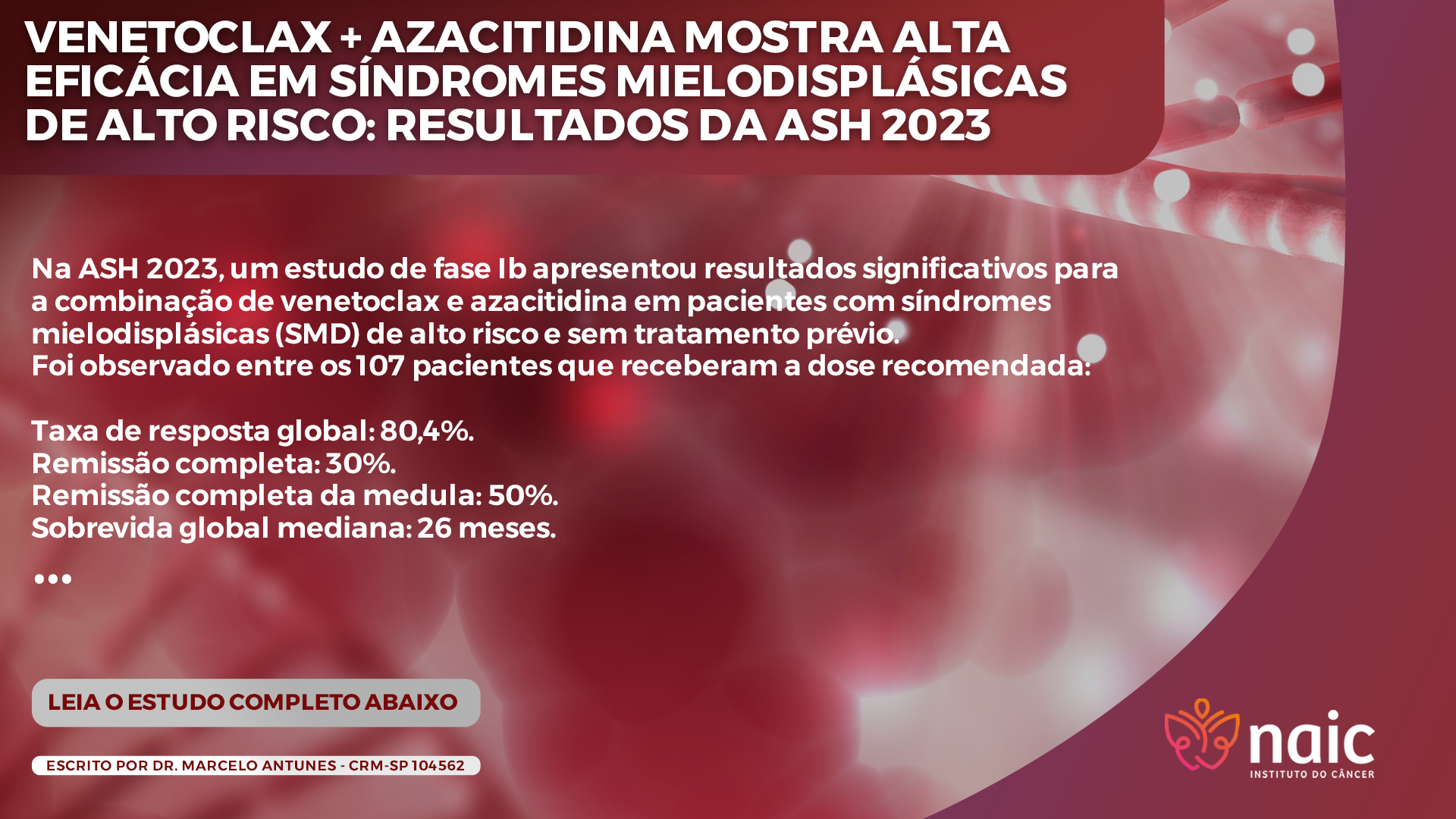 Venetoclax + Azacitidina Mostra Alta Eficcia em Sndromes Mielodisplsicas de Alto Risco: Resultados da ASH 2023