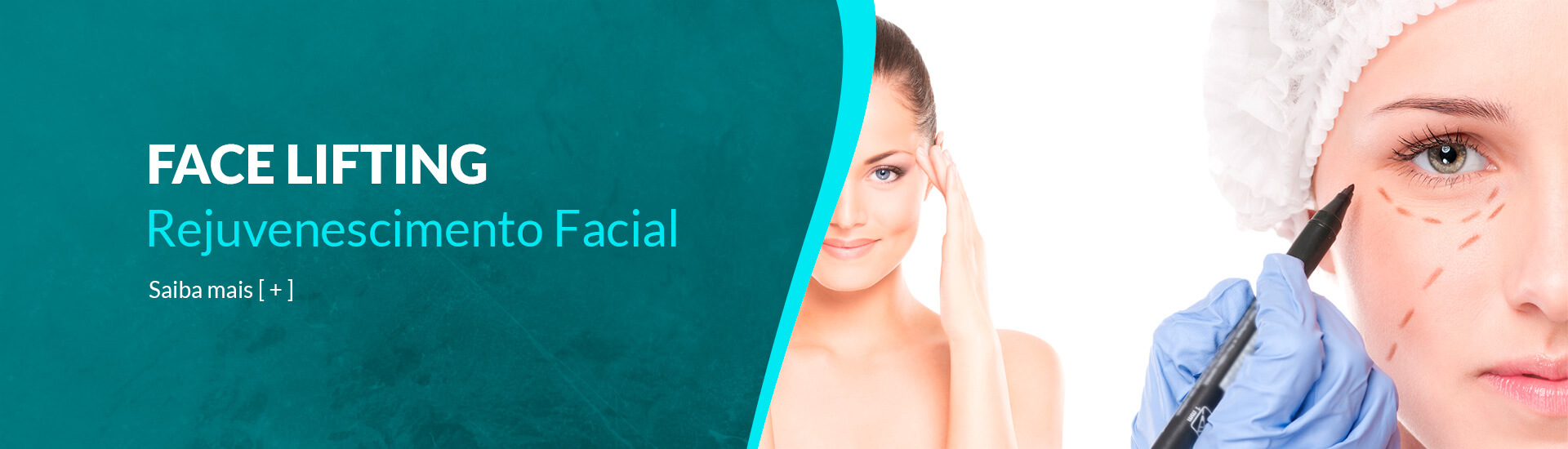 Face Lifting